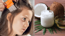 Effective Home Remedies and Precautions for Head Lice Infestation..!