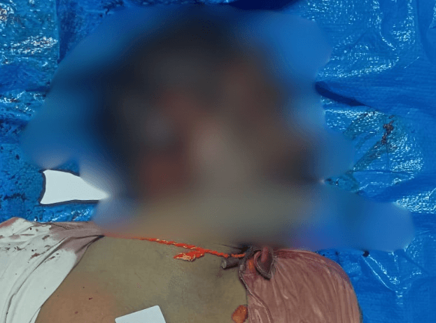 ಸುತ್ತಿಗೆಯಿಂದ ಭೀಕರವಾಗಿ ಹೊಡೆದು ವ್ಯಕ್ತಿ ಹ** ಮಾಡಿದ ಹಂತಕ.!
