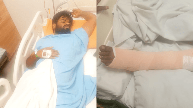 ರಕ್ಷಕ್ ಬುಲೆಟ್ ಮಹಾ ಎಡವಟ್ಟು..ಬೈಕ್ ಸವಾರನಿಗೆ ಜೀಪ್ ಡಿಕ್ಕಿ! ಕಾಲು ಮುರಿದ!
