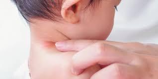Use of Cosmetics on Children Can Cause Hormone Disruption and Allergies: Caution Urged!